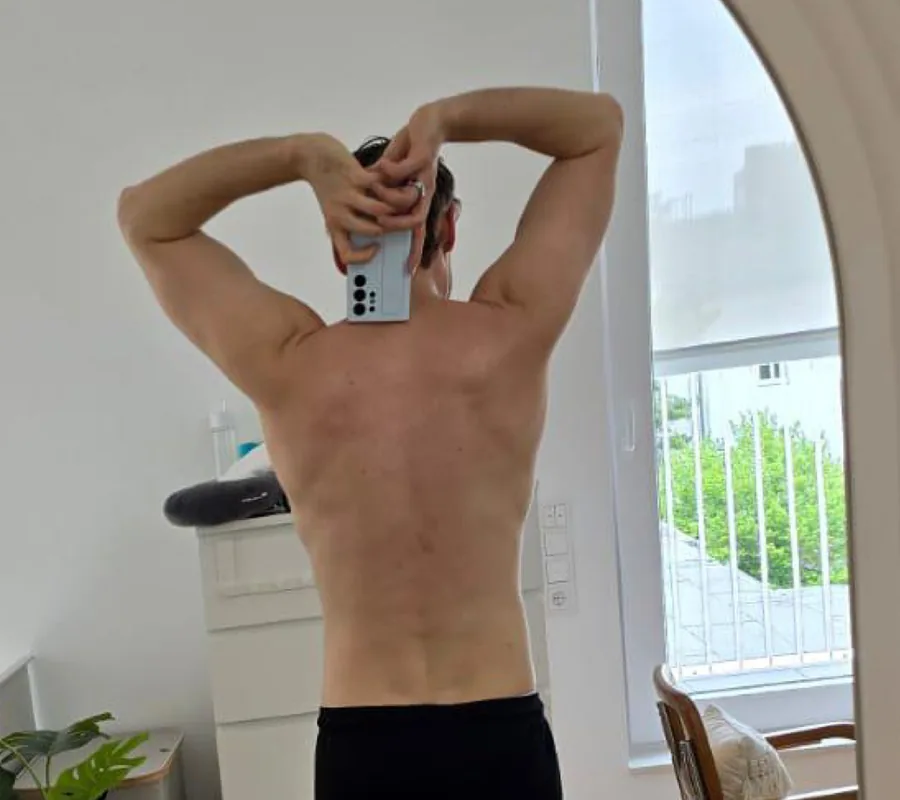 Rücken eines Privatklienten vor dem Coaching bei Marcus Bock
